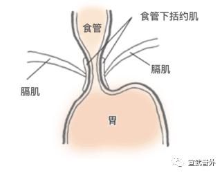 括约肌|想吃东西，胃不“开门”