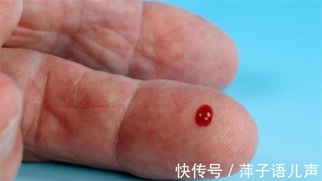 血糖|医生提醒:血糖高的人,尽量少吃这3类食物,你可能不听劝