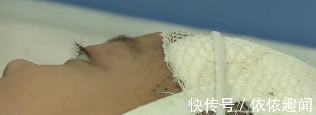 癫痫|4岁女童头上的胎记,一查竟是血管瘤,医生给出了答案