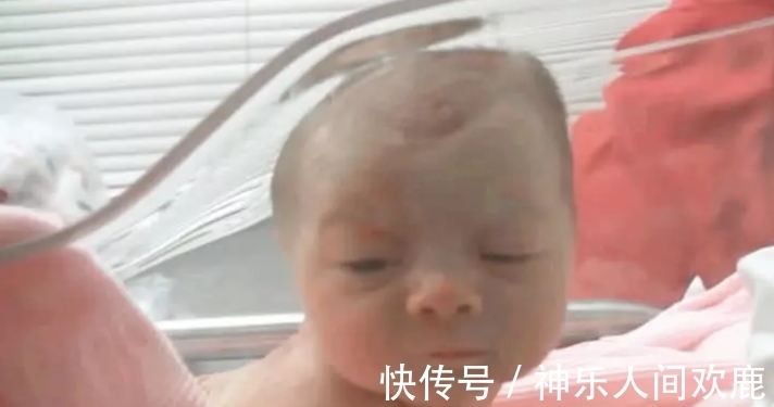 闪光灯|刚出生两天的婴儿听到妈妈的声音,居然抬头看妈妈,医生都看愣了