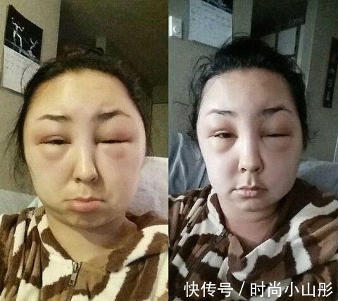 染发剂 长春一女教师 ，因染发竟呼吸衰竭去世，头发到底还该不该染