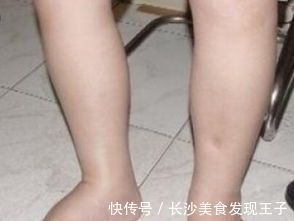 肝癌早期|肝癌早期不止肝疼，3种症状，及时发现，才不会延误治疗！