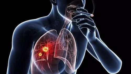 肺部|秋季干燥肺易生病？学会养肺3步法，养肺养生两不误