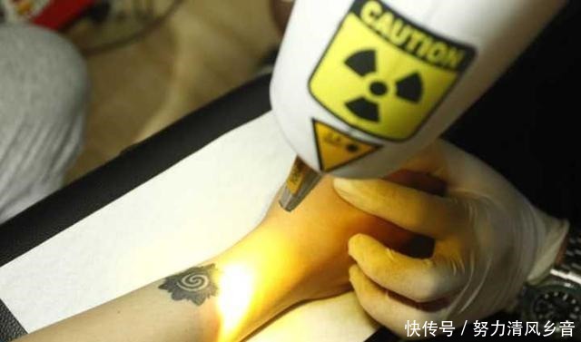 草帽|网友把草帽团纹在了腿上,好看是好看,老了怎么办
