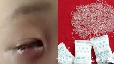 氧化钙|3岁儿子吃了半包干燥剂,妈妈一个举动救了娃,医生:比我还高明