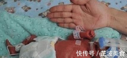 流产|女孩怀孕多次没能有孩子,第8次终于有了结果,医生和护士却傻了