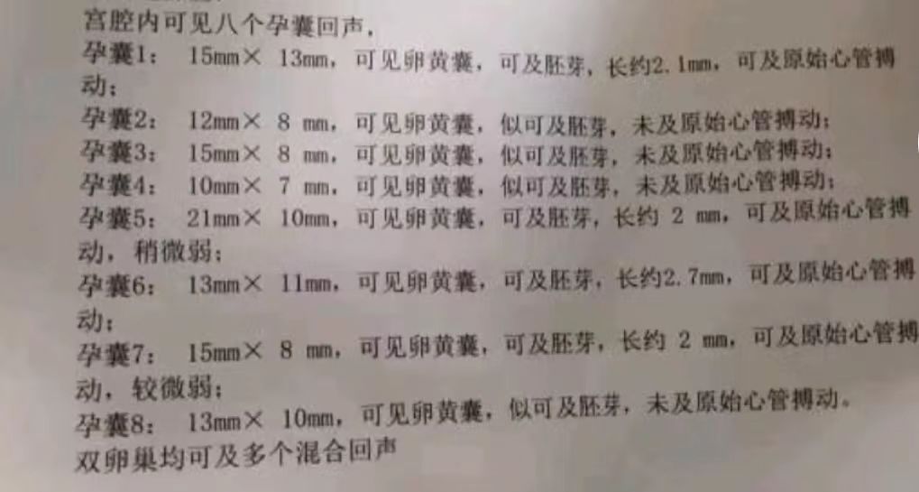 河南|改变想法了！河南女子怀上八胞胎，打算留1到2个孕囊