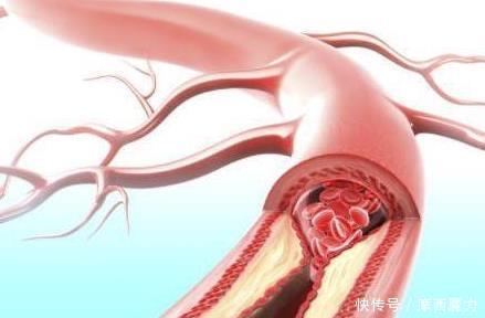 常吃鱼身体好,医生提醒有2种鱼是例外,最好一口都别碰