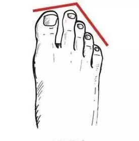 美女脚 你的脚型穿对了鞋吗希腊脚是公认的美女脚,很多人是埃及脚