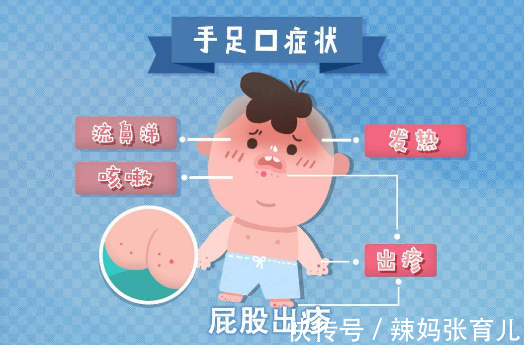 宝宝|原本以为夏季才是手足口病的高发期,没想到冬季也是