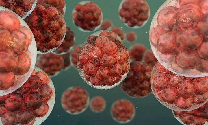 干细胞|TAA Medical统恩医学的干细胞疗法对120例重型狼疮肾炎临床疗效评估