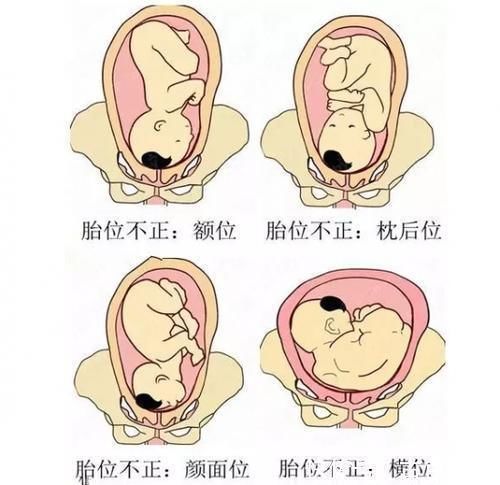 孕妇|孕妇生下“白雪公主”,医生吓出冷汗胎儿的血竟被妈妈“吸走”