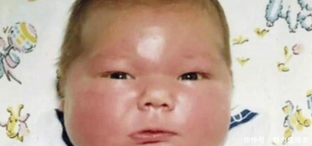 婴儿|37年前,那个出生时14.5斤的“巨婴”,现在长大后成啥样了?