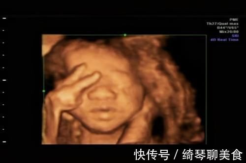 彩超|被宝宝的四维彩超照丑哭了?不是医生技术不好,而是有客观原因的