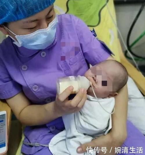 奶粉|那个出生才4百克的“巴掌公主”,半年过去怎样了?生命真是神奇