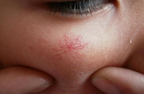 蕨菜|28岁女子养生养出肝硬化?忠告:不想肝功衰竭,3种蔬菜立即撤下餐桌