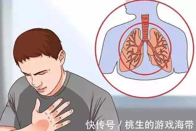 吸烟|注意:皮肤有三个异常表现,尽早查查肺