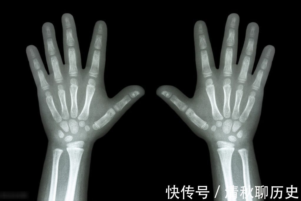 生长发育|天天喝牛奶吃钙片,孩子还是不长个子?孩子身高每年长多少正常?