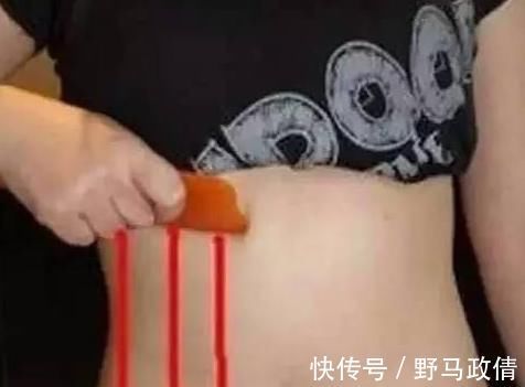 赘肉|强力燃脂减肚子赘肉，只需每天刮2下，就能轻松拥有迷人马甲线！