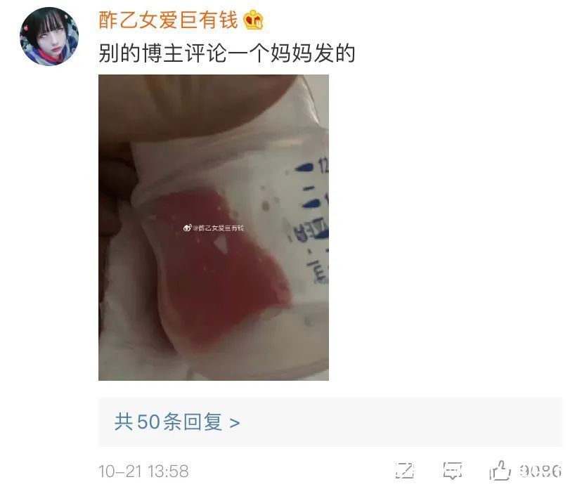 孕产妇|孕产妇蚂蚁腰,不必!