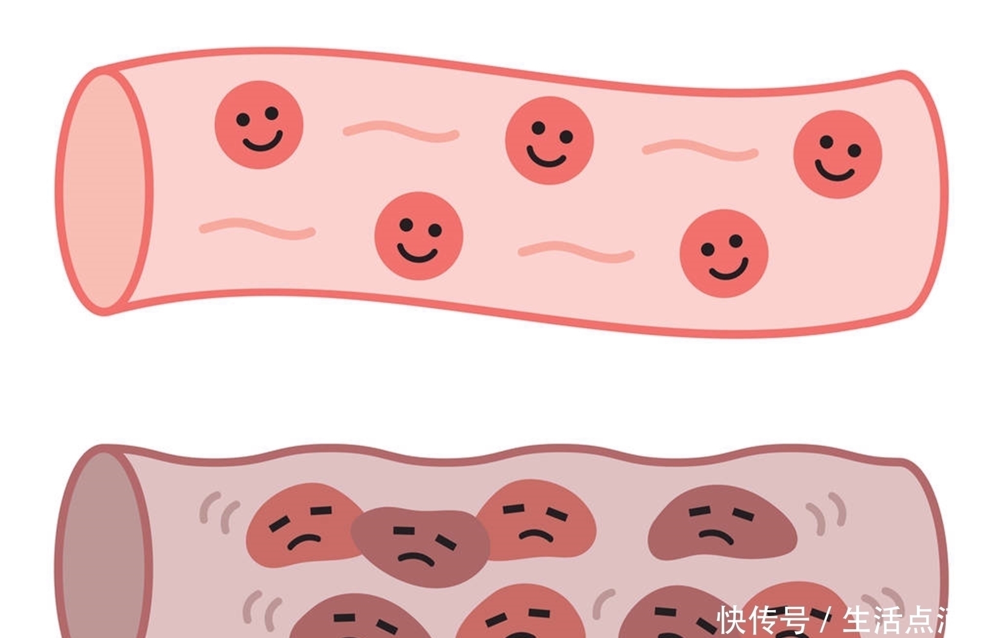 梨子|“溶栓高手”发现了,不是洋葱,隔三差五地喝,血栓也许悄悄没了