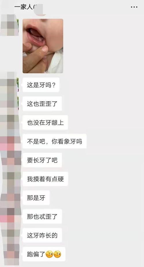 告诉|带娃经验分享4个月宝宝出牙却不是牙 医生还告诉我不需要治疗