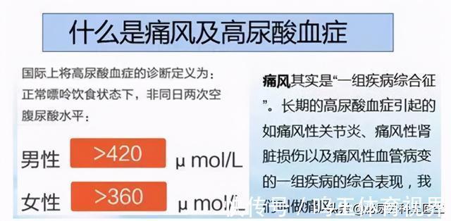 高尿酸|3种“碱性食物”，对排出尿酸有利，建议高尿酸患者要常吃