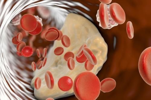 胸腔积液|肺癌最可怕的不是疾病本身，而是伴随的并发症