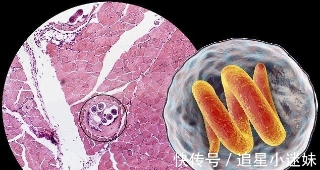 食材|一口能吃出几千条“寄生虫”?有3种食材可能是寄生虫的“最爱”