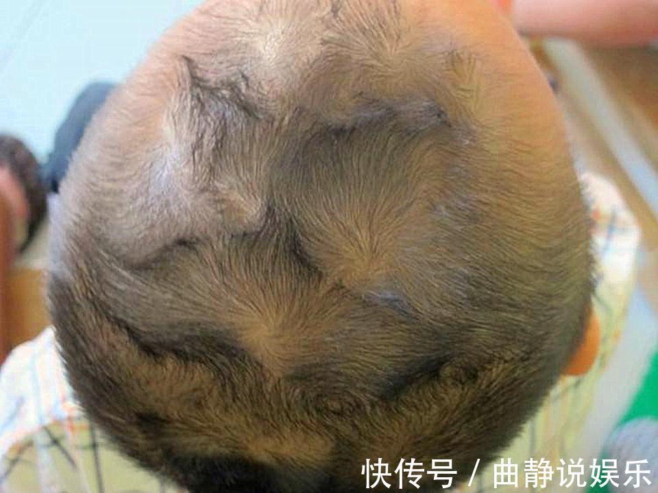二旋宁|孩子头上有几个旋,就会有什么样的人生许多爸妈不知道