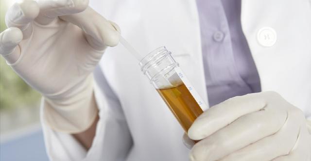 肝脏疾病|肝不好的人,上半身藏不住,出现这4种标志,尽快检查肝功能