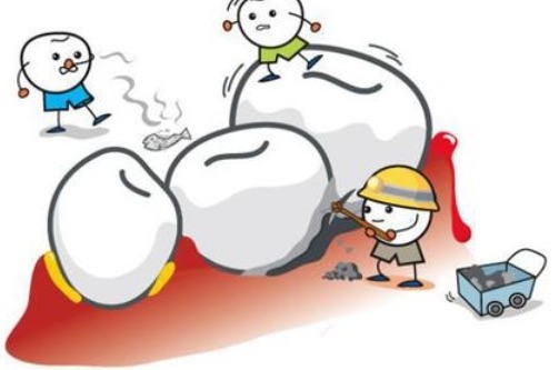 小苏打|“牙结石”用手抠无用功，专家教你1招，脏东西不久“哗哗”掉！