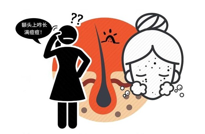 红豆性|湿气太重,4个表现难逃!建议:坚持“1泡1喝”,驱寒除湿