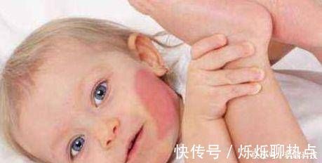 胎记|怀孕期间,经常做这两件事的孕妈,胎儿容易长胎记,后悔都来不及