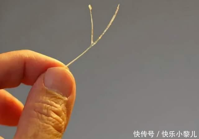 四岁女儿被鱼刺卡喉,家长用机智救了娃,医生:优秀的父母