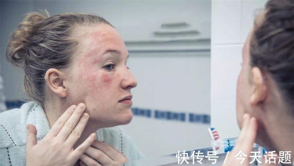 秘籍 针对敏感肌的4个护肤小“秘籍”,让你永久性摆脱“烂脸”敏感肌