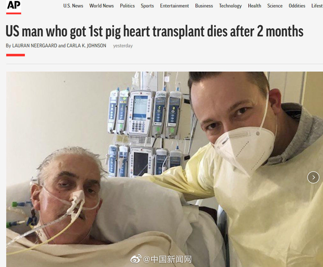 The world's first porcine heart transplant patient dies