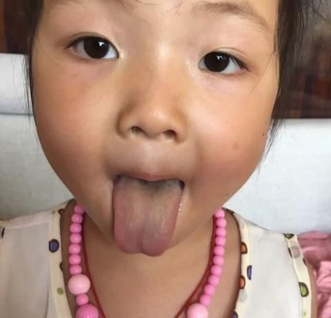 消化|吃一次整整7天不消化,父母经常喂孩子吃,医生:孩子怎还能发育