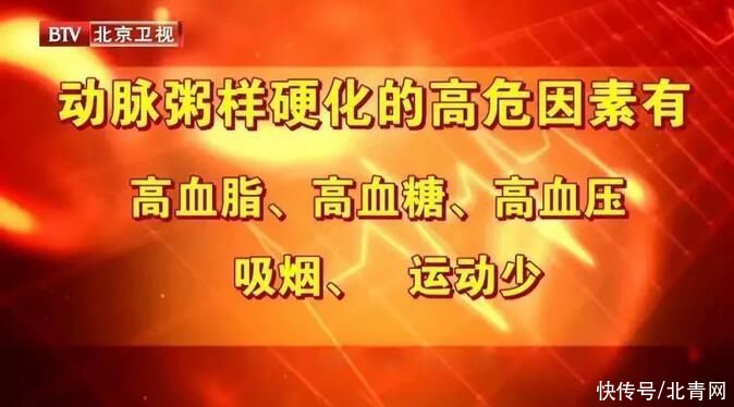 冠心病|血脂偏高不仅会诱发心脑血管疾病，还会加快衰老