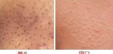 这些清洁面膜如果停产了,我简直世界崩塌!