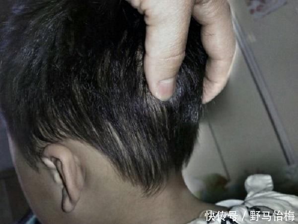 孩子|这4个部位是孩子的“生命线”,多生气也不能打,别因失控而后悔