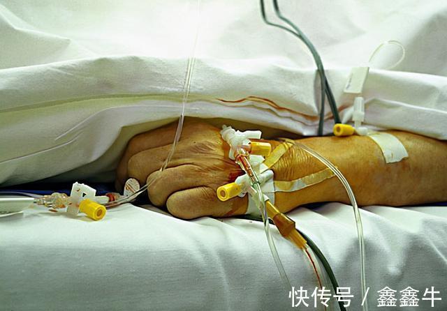 苹果|大婶一天一个苹果，为何紧急送医，检查出肝癌晚期？