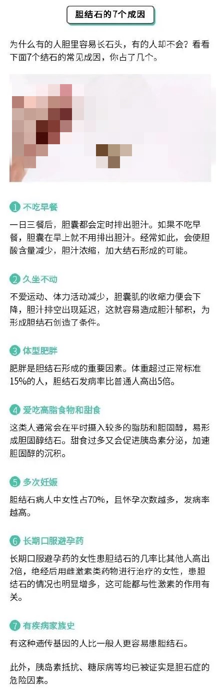 胆囊结石|妻子怀孕丈夫陪吃，双双吃出这种病！原因是这些汤