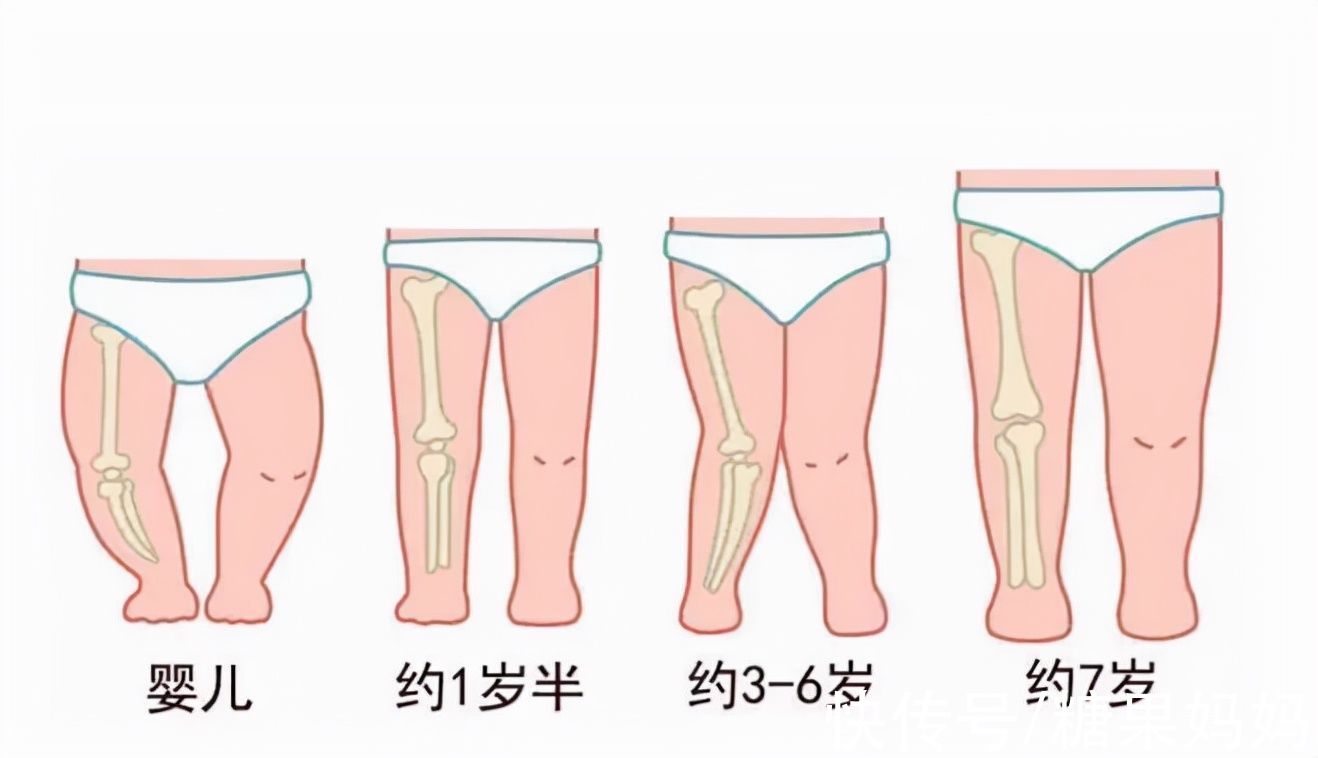 宝宝|3大误区影响宝宝腿部发育，不尽早改正，小心娃的腿又弯又短