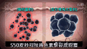 反黑 做完光子嫩肤之后反黑了怎么办呐?什么是反黑?术后该如何护理?