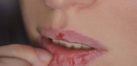 女生如果不想变“香肠嘴”,这4个坏习惯一定要改,中一个都不行