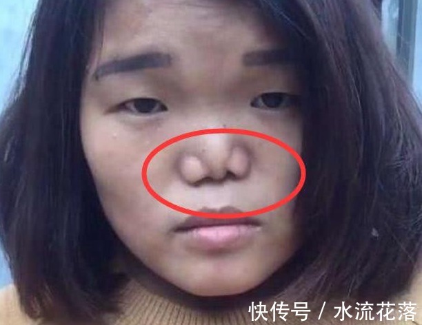 大蒜|被公认的三种“丑鼻子”,中了颜值不会太高,没中的小仙女偷笑吧