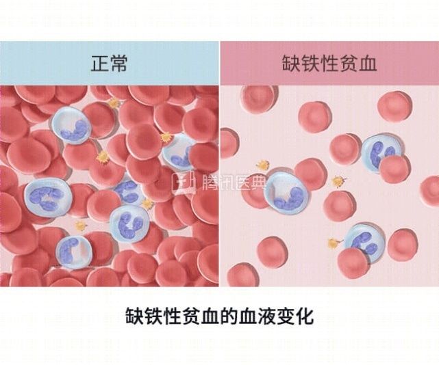 优质蛋白|红枣补血？真正有用的是这3类食物，尤其第1个