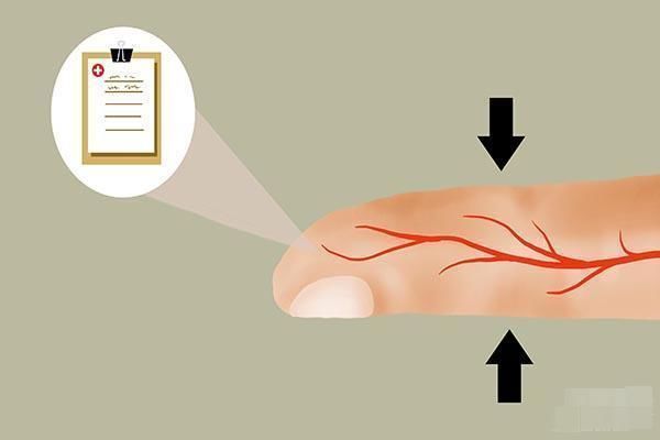 血糖水平|血糖高的人,不光要忌口甜食,这3味调料也要少碰