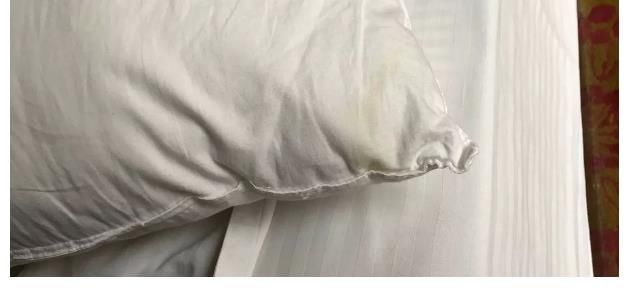 女子|23岁女子查出HPV，医生大骂：有3样东西，再懒也不能和舍友共用